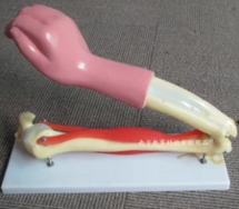 肘關(guān)節(jié)活動(dòng)模型